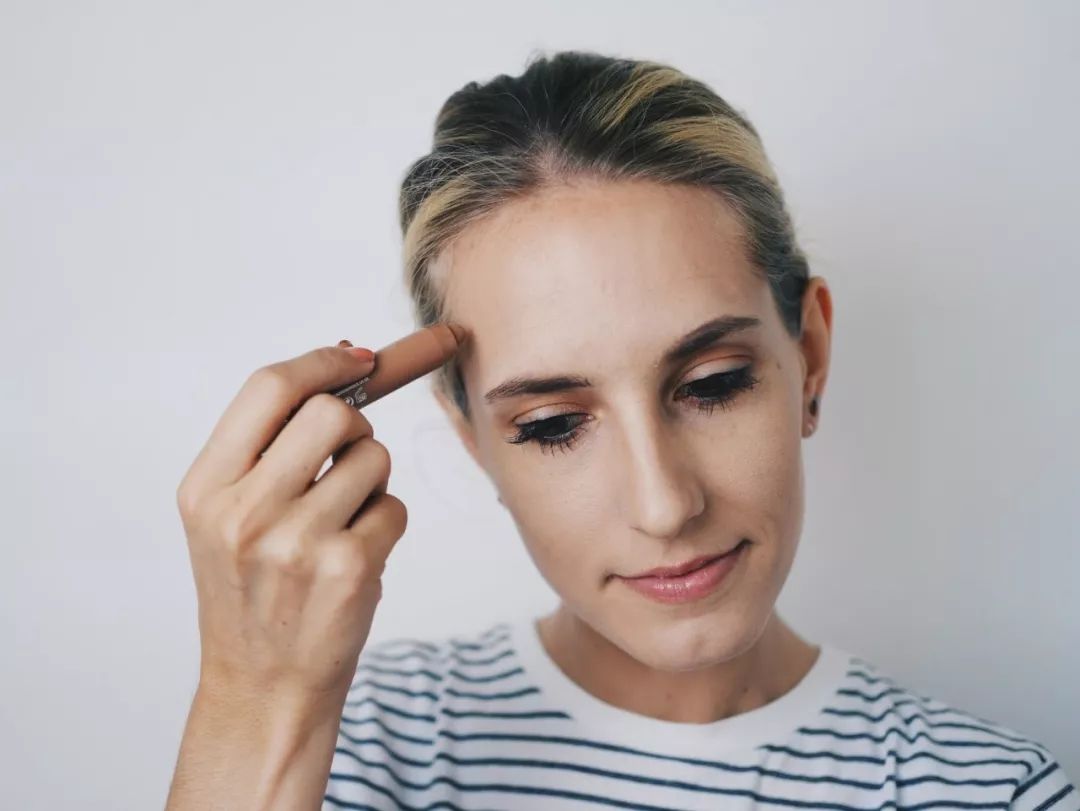 揭秘种植发际线,发际线种植真实体验