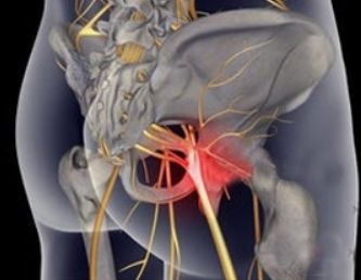 腰间盘突出：针对夏季的康复锻炼，坚持一个月，养出好腰椎！