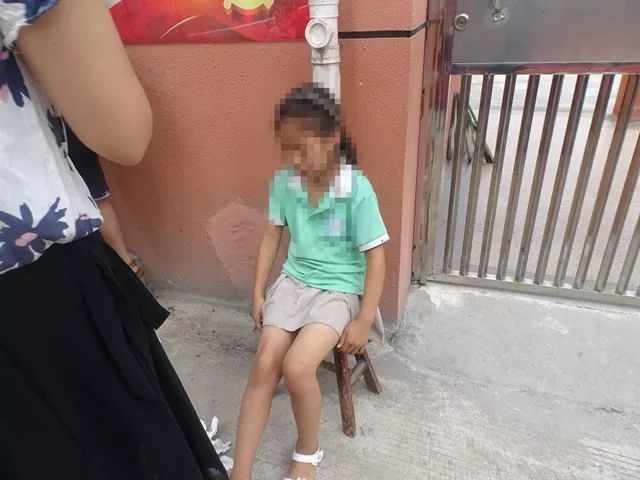 浙江女子脚被门缝夹住,一女子脚被门缝夹住