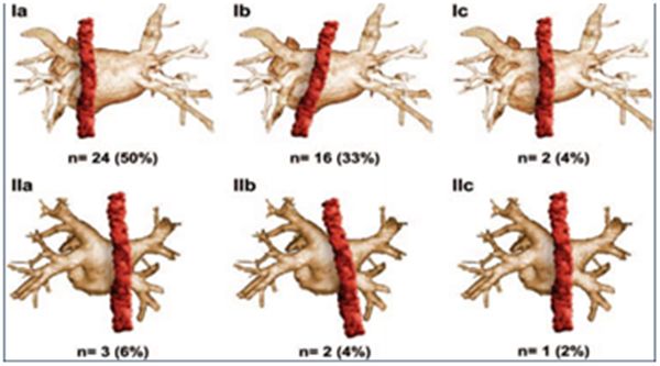 房颤力量训练,房颤的治疗讲座