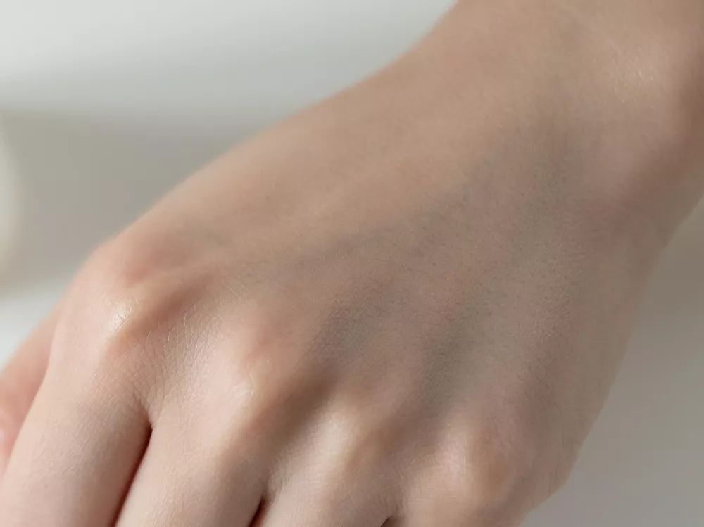 28天解决了所有皮肤问题，你猜我做了些什么？