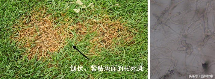 草坪常见病害防治方案,草坪禾草最常见茎叶病害