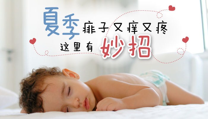 宝宝夏天防痱小攻略,夏天宝宝预防痱子必备