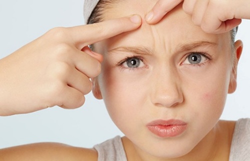 油痘肌祛痘最好的精华,油豆皮最好的护肤品