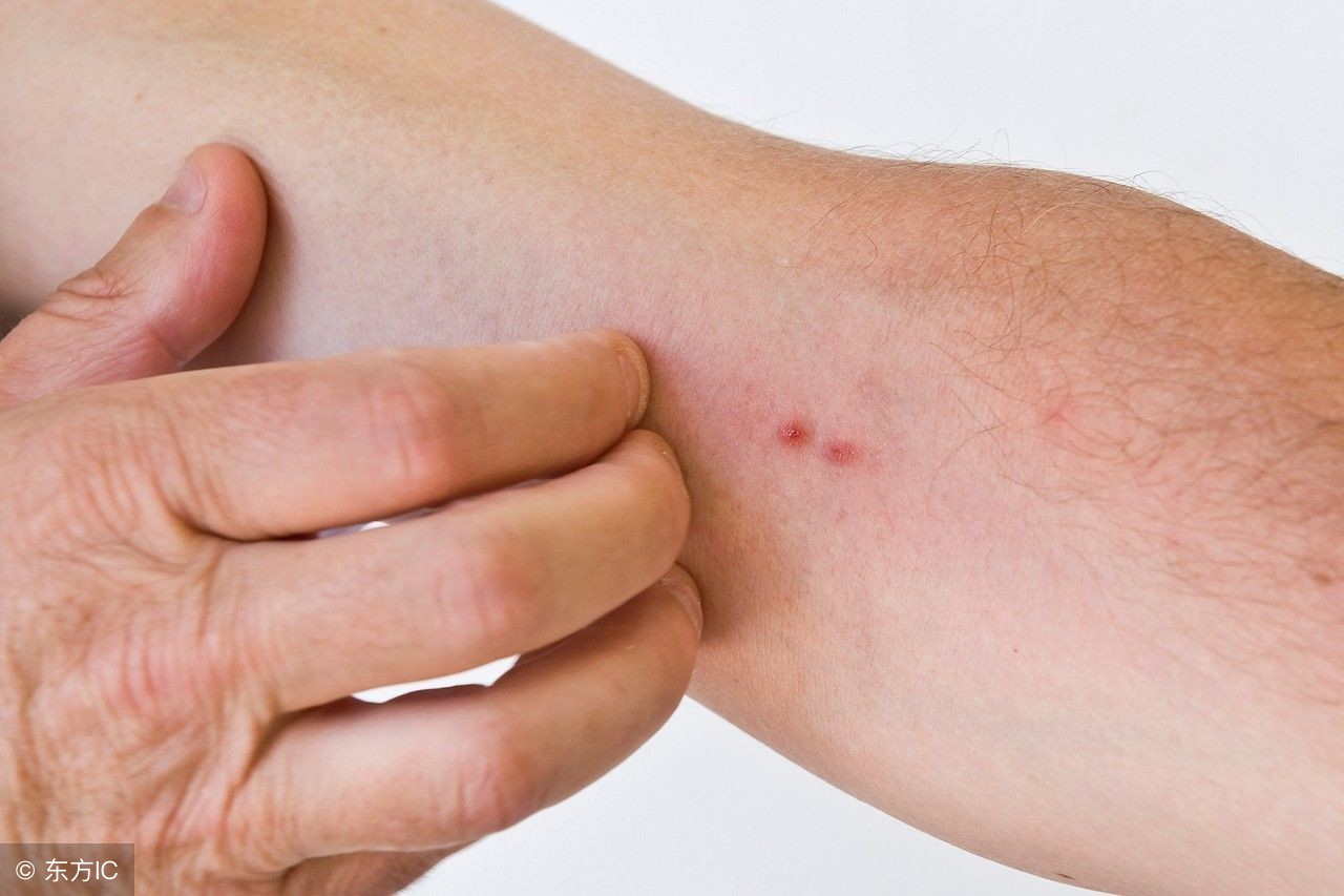 风油精孕妇可以用吗？它还有哪些不为人知的用途？