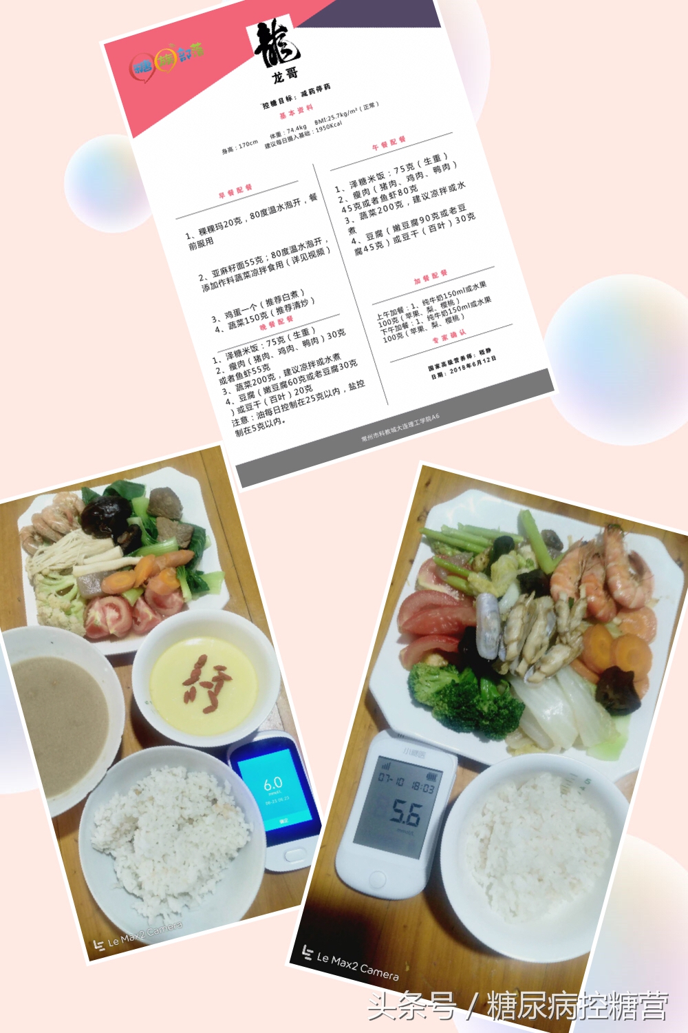 糖尿病足溃疡半年不痊愈,糖尿病引起的脚背溃烂容易治疗吗