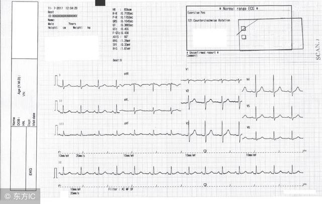 早搏吃什么食物最好,早搏最怕吃什么食物