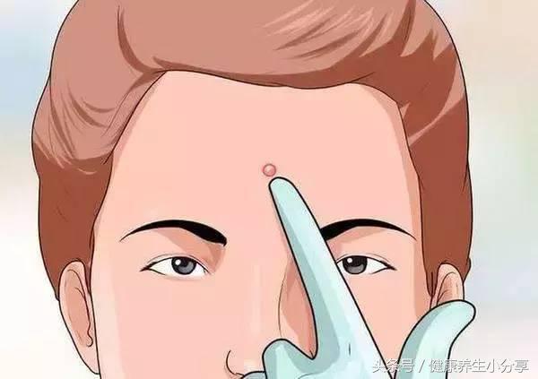 螨虫的天敌和克星,螨虫攻击你了你应该如何解决