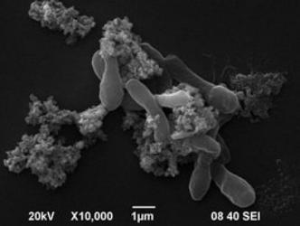 产苞乳酸菌——凝结芽孢杆菌，了解一下！