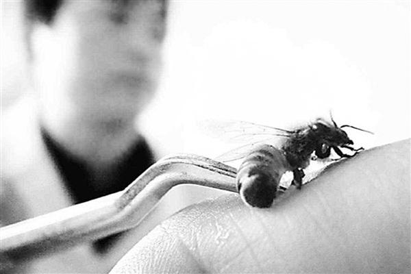 突然被蜜蜂蜇咬了怎么办,蜂蜇伤为什么会过敏