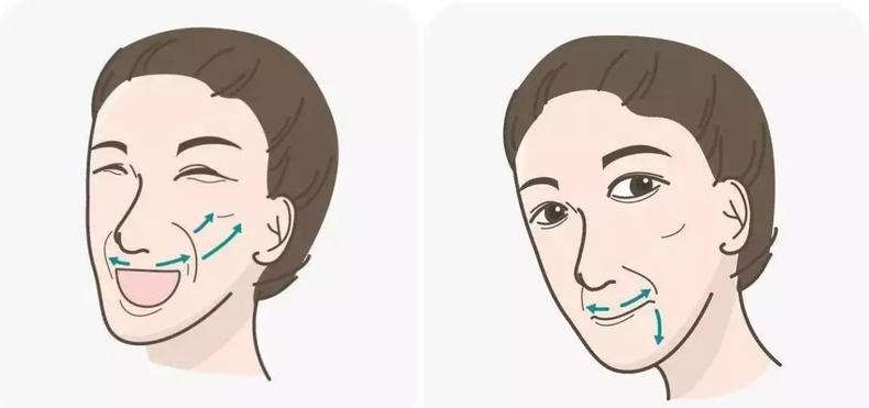 林允有没有鱼尾纹,林允法令纹