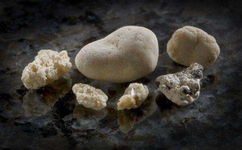 输尿管结石10x5mm要做手术吗,输尿管结石保守治疗方法有哪些