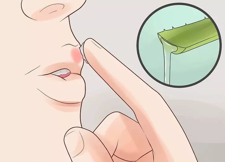 嘴巴上起泡快速消除小窍门,嘴巴上起泡了是怎么回事