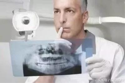 整牙全过程解说,整牙亲身经历15天