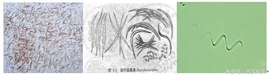 赤潮最常见的藻类有哪些,不属于环境中常见藻类