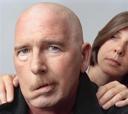 肉毒素治疗面肌痉挛操作视频,肉毒素治疗面肌痉挛的疗效如何