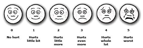 宝宝摔下床无事的表现,婴儿摔下来脑震荡症状是什么