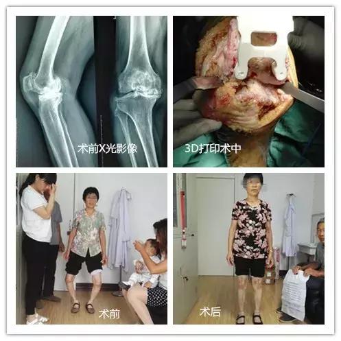 邯郸峰峰集团总医院邯郸分院,邯郸峰峰骨科医院电话