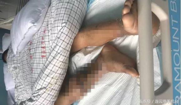男子被虾扎手抢救无效身亡,男子被虾扎手后续