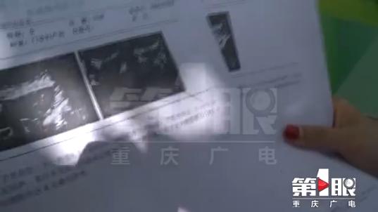 孕妇遵医嘱药流无效后做清宫手术又被告知宫外孕