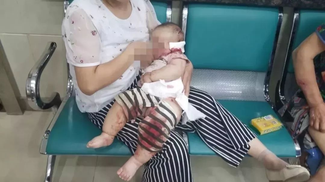 “嘴笼”恒久远,一套永流传!出门前给你家狗子戴上才是真的爱啊!