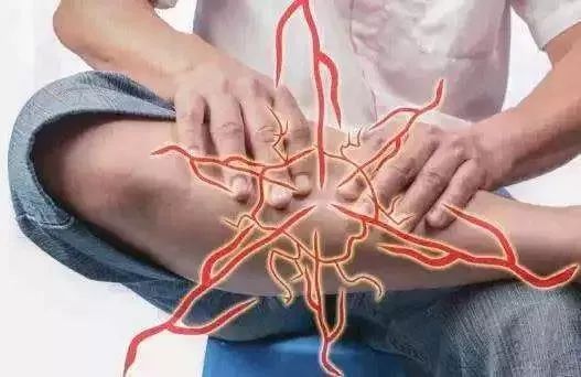 腿抽筋是缺钙引起的吗,腿抽筋是缺钙吗究其原因都有哪些