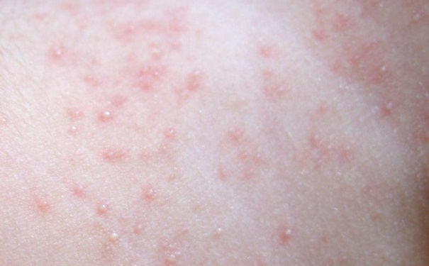 鎮勬倓涓婄嚎,鎮勬倓涓婄嚎鐨勬柊鐩存挱鍔熻兘