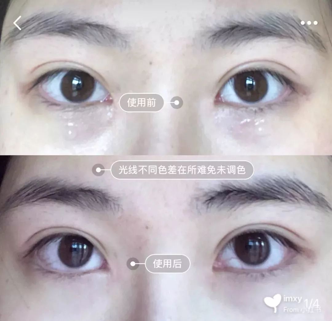 平价眼霜去细纹30岁,30岁以上淡细纹平价眼霜