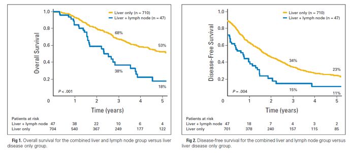 直肠癌一枚淋巴结转移意味着什么,结直肠癌肝转移同期切除