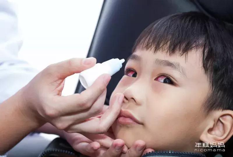 眼睛红眼屎多有点痒是怎么回事,小孩眼屎多眼睛周围红是怎么回事