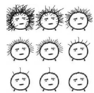 拯救90后,拯救90后的发际线