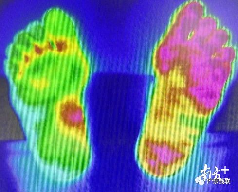 红外线热成像能查出身体的问题,神奇的红外热成像检查
