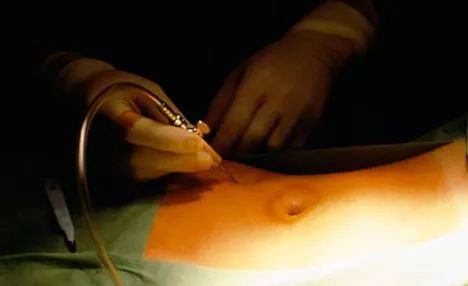 “17岁少女卖卵”刷屏，“疼哭”还不是最可怕的