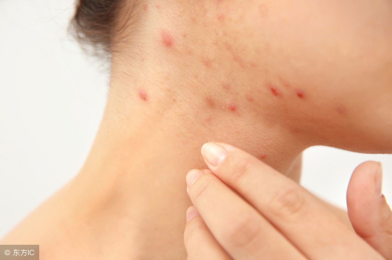 床单被罩多久洗一次去螨虫,被子床单多长时间换一次避免螨虫