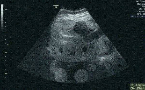 怀孕的搞笑b超图,怀孕了想睡觉表情包