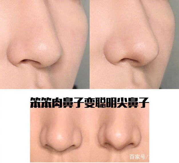 如何拯救肉鼻子，这样做立马从扁塌鼻变欧美高鼻梁！