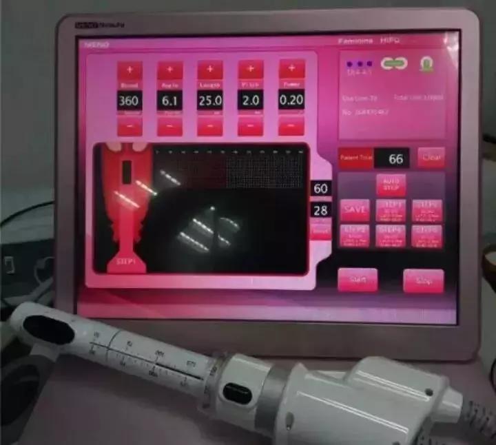 整容哪种项目是大手术,整容其实没啥可怕的事情