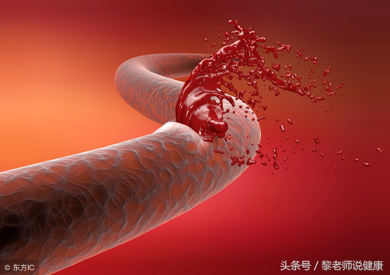 中年人低血压的原因及治疗方法,低血压要注意哪些