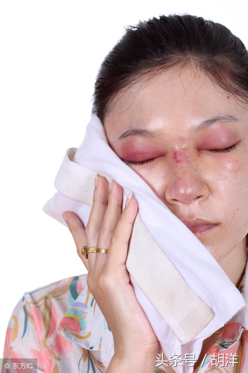 早上起床眼泡肿是怎么回事,起床眼胀