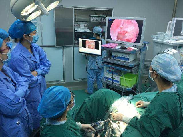 妇科专家教你认识宫腔镜,科普妇科专家带你认识宫腔镜