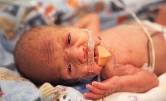 早产宝宝如何护理新手爸妈必看,先兆早产的护理问题及护理措施