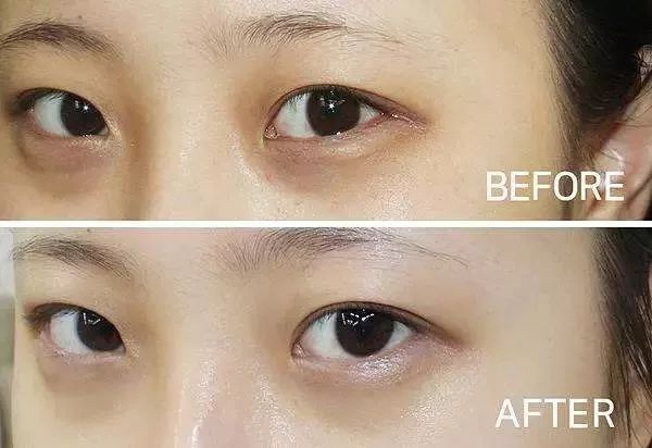 追剧福利礼包领取,追剧有哪些福利