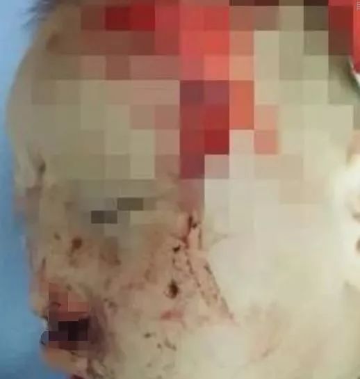 濮阳最近被曝光的小区,最新濮阳新闻报道小区