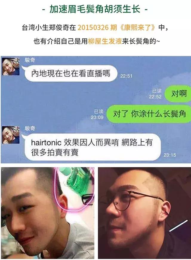发际线高脱发用什么洗发水,发际线高掉头发洗发水测评