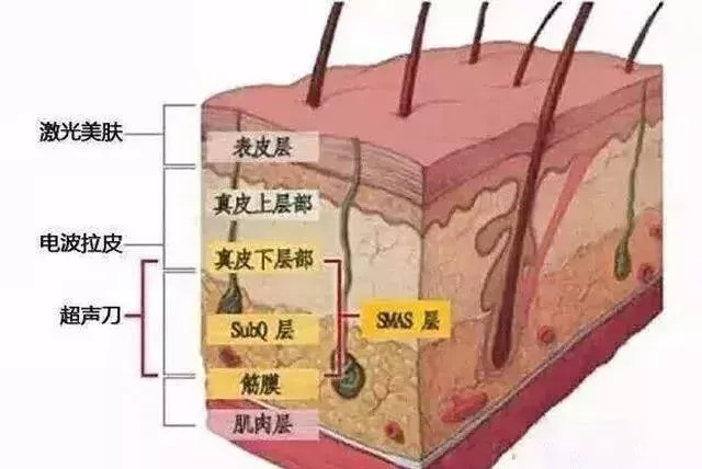 refa美容仪按摩颈纹,refa美容仪球掉了怎么装