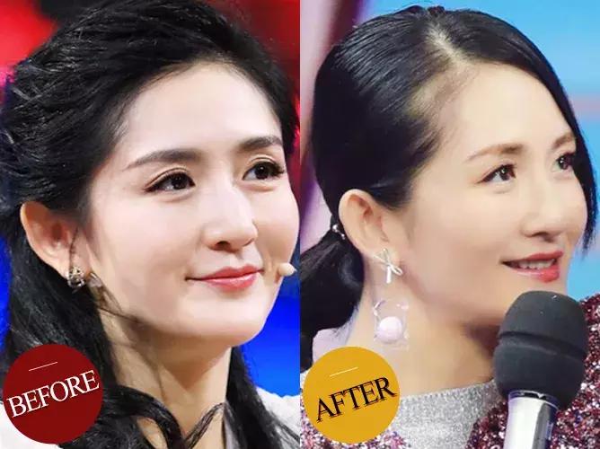 防脱发女生,防脱发明星代言哪个好