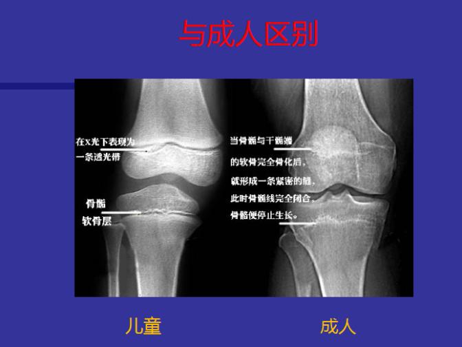 骨骺损伤手术修复后能恢复正常吗,儿童骨骺损伤手法复位