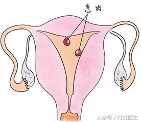 大姨妈有血块什么情况,大姨妈有血块是什么原因