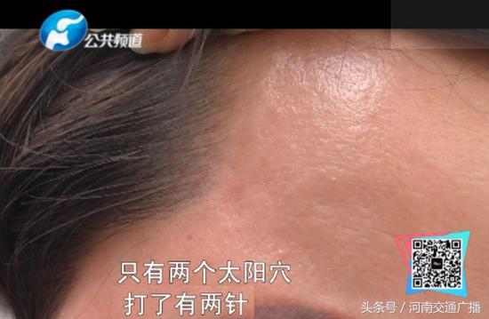 郑州整形医院最新骗局套路,郑州整形医院最新骗局揭秘