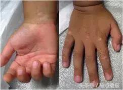 儿童笔危险,儿童水彩笔有害